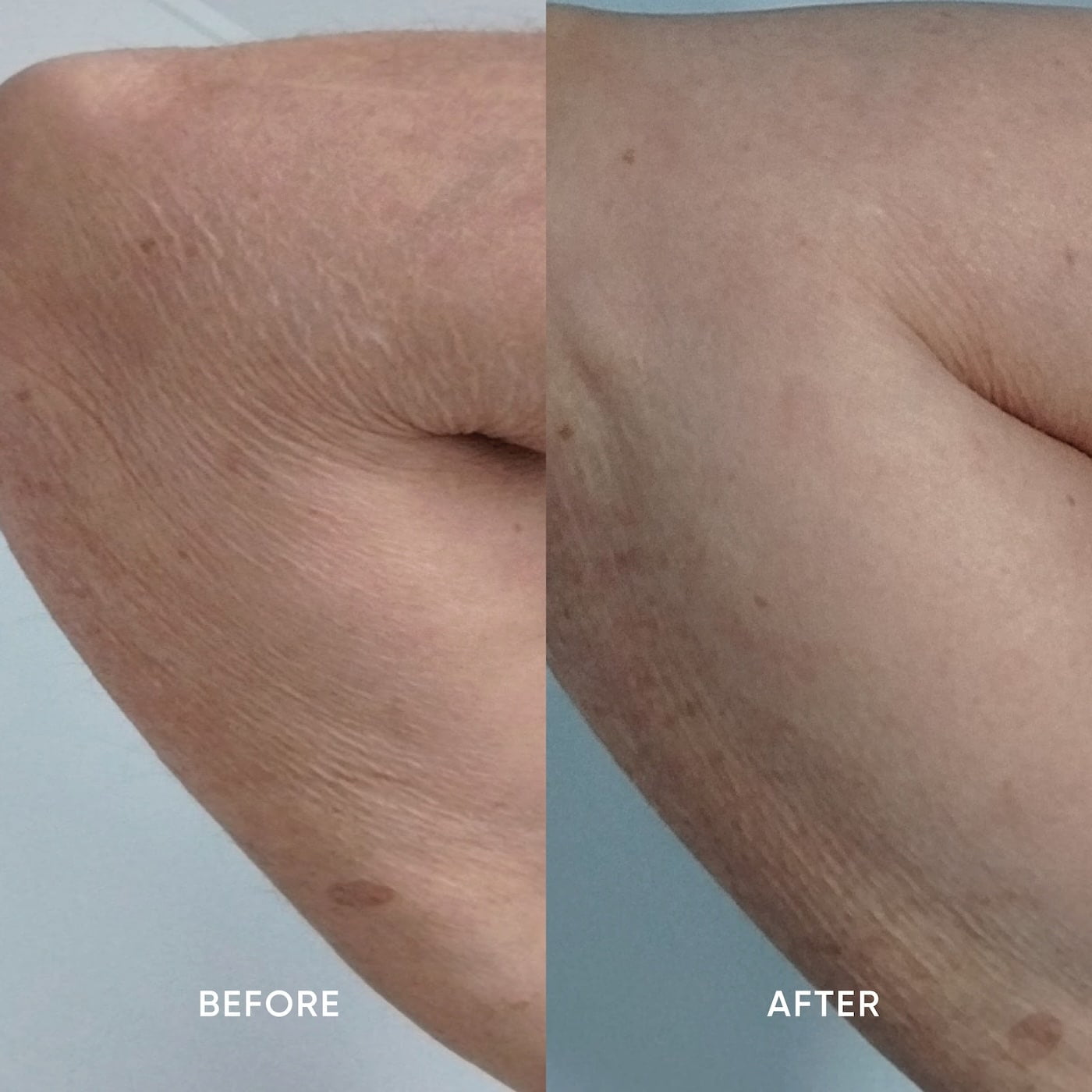 ManukaRx Firming Body Lotion product trial before and after side by side images