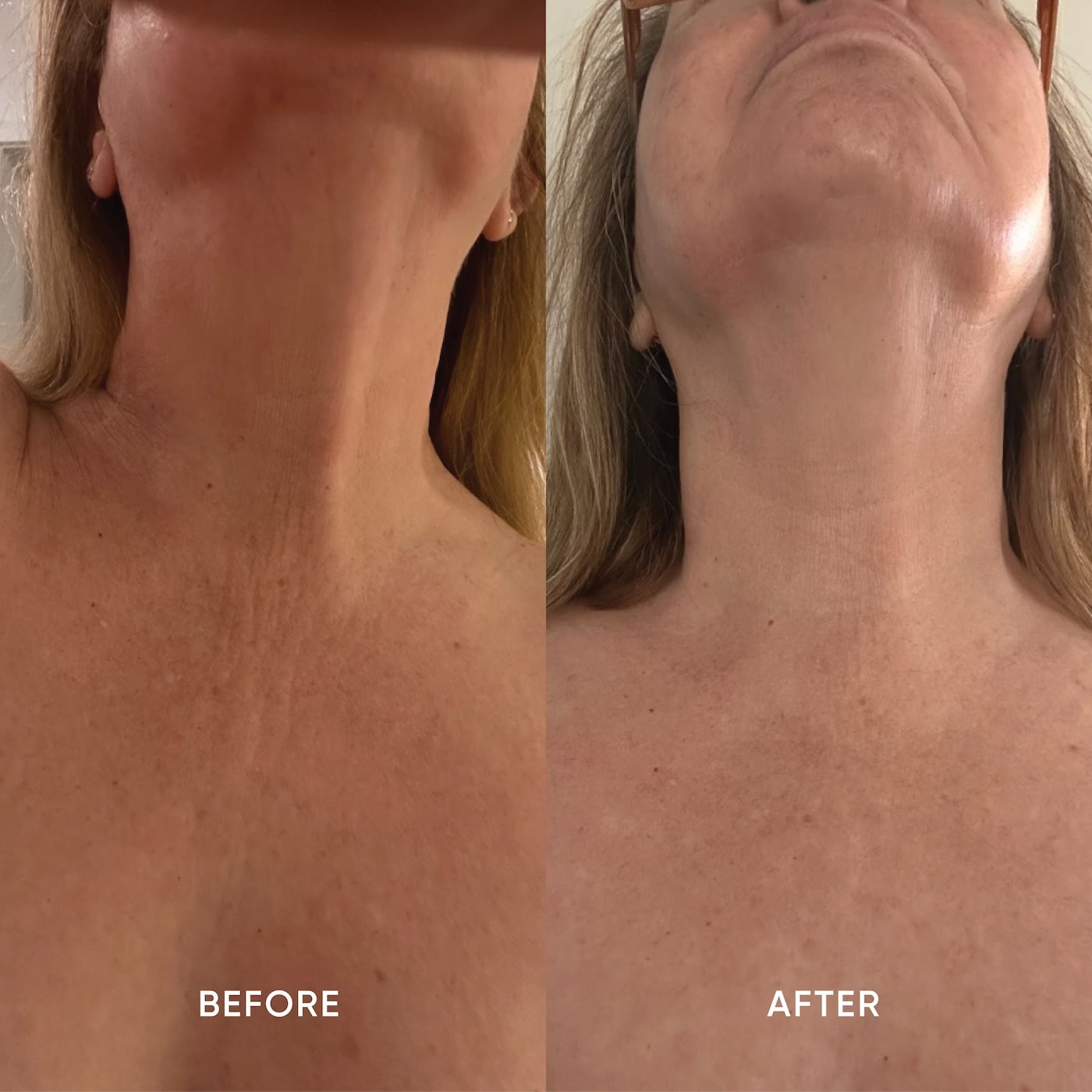 ManukaRx Firming Neck Cream before and after trial images shown side by side of woman's neck and décolletage