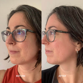 ManukaRx Firming Day Cream product trial before and after side by side comparison photos